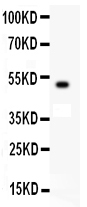 1 - Anti-KIT/SCFR Antibody ABO11949