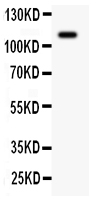 1 - Anti-KIT/SCFR Antibody ABO11949