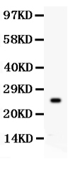 1 - Anti-Kallikrein 3 Antibody ABO11950