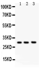 1 - Anti-Kallikrein 3 Antibody ABO11950