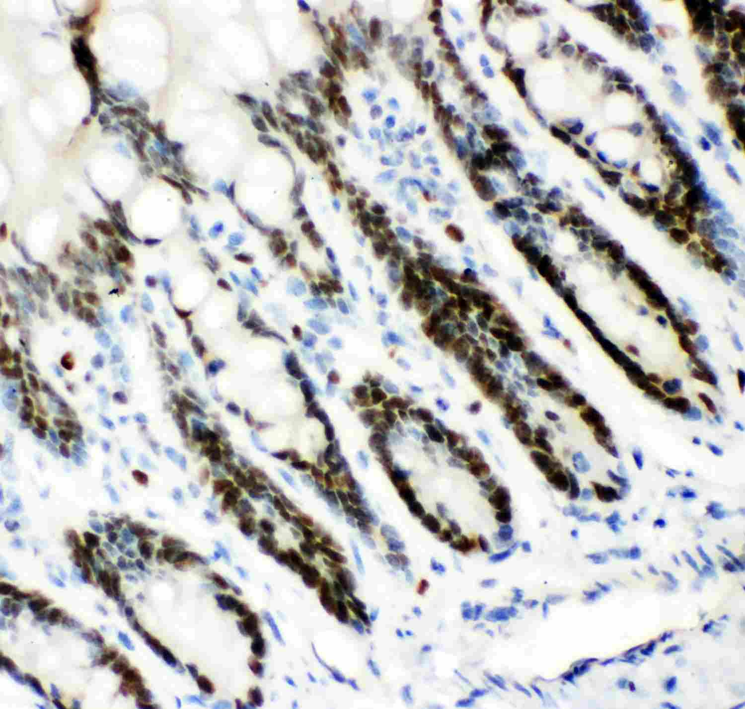 2 - Anti-MCM7 Picoband Antibody ABO11952