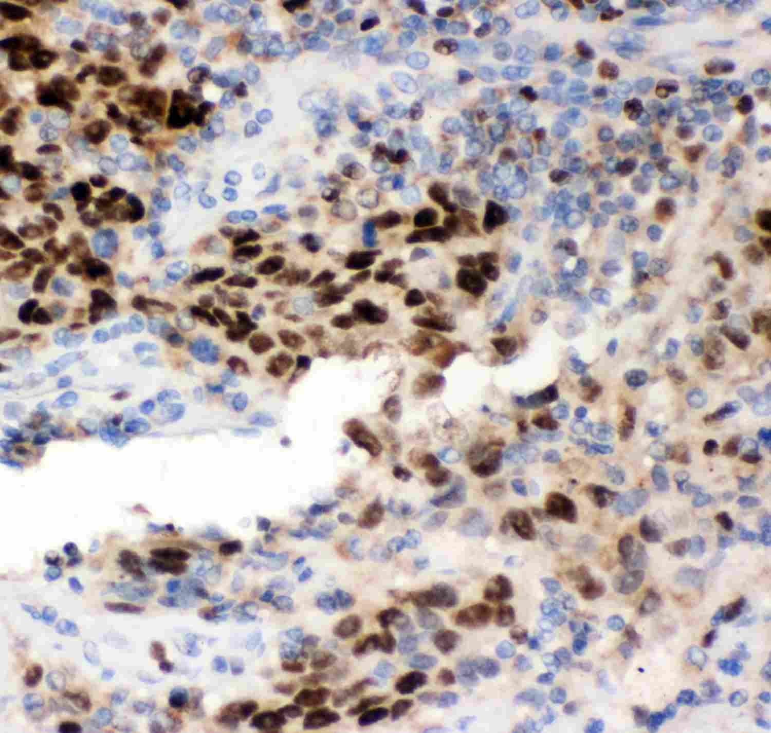 2 - Anti-MCM7 Picoband Antibody ABO11952