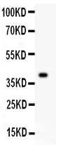 1 - Anti-MCM7 Picoband Antibody ABO11952