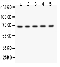 1 - Anti-Menin Picoband Antibody ABO11954