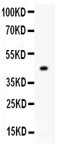 1 - Anti-Mitofusin 2 Picoband Antibody ABO11956