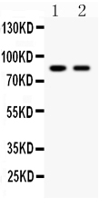 1 - Anti-Mitofusin 2 Picoband Antibody ABO11956