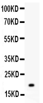 1 - Anti-MGMT Picoband Antibody ABO11957