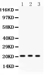 1 - Anti-MGMT Picoband Antibody ABO11957