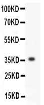 1 - Anti-MMP-3 Antibody ABO11958