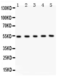 1 - Anti-MMP-3 Antibody ABO11958