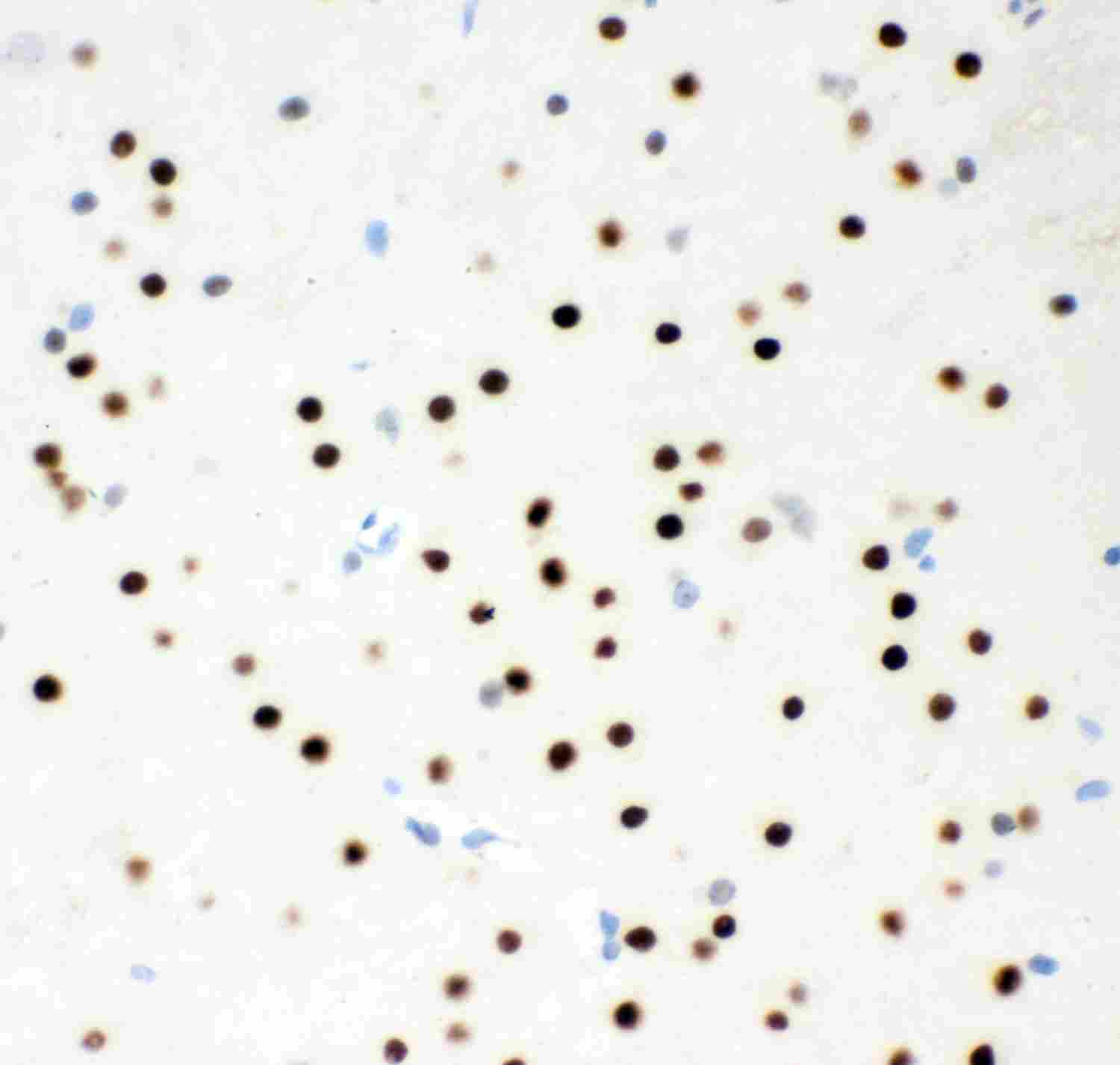 2 - Anti-MSK1 Picoband Antibody ABO11959