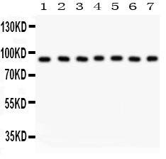 1 - Anti-MSK1 Picoband Antibody ABO11959