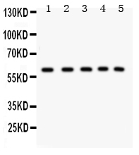1 - Anti-LKB1 Picoband Antibody ABO11961