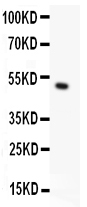 1 - Anti-TRPC5 Picoband Antibody ABO11962