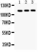 1 - Anti-TRPC5 Picoband Antibody ABO11962