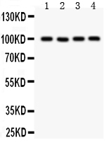 1 - Anti-TRP 7 Picoband Antibody ABO11963