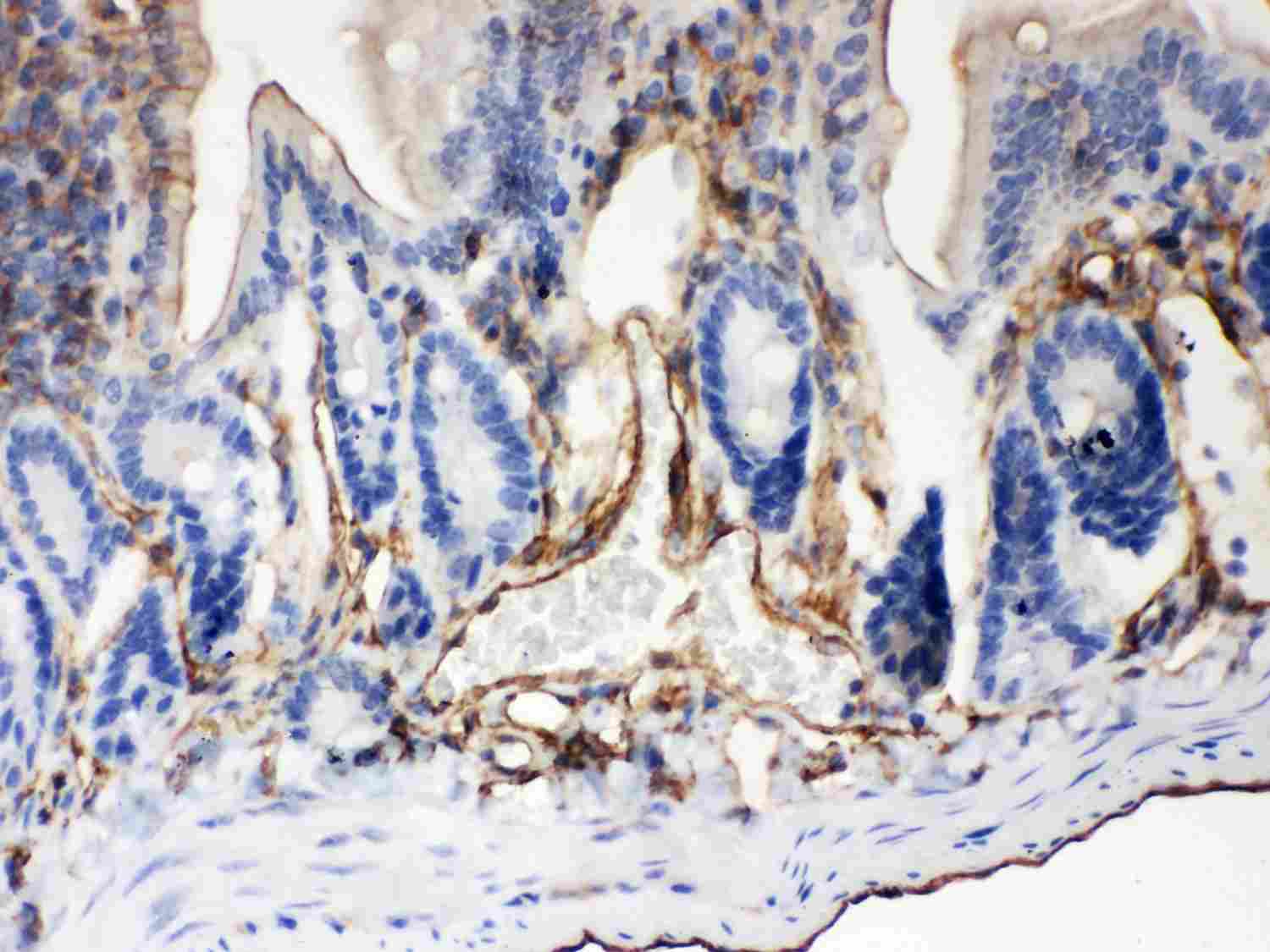 2 - Anti-ABCB4 Picoband Antibody ABO11966