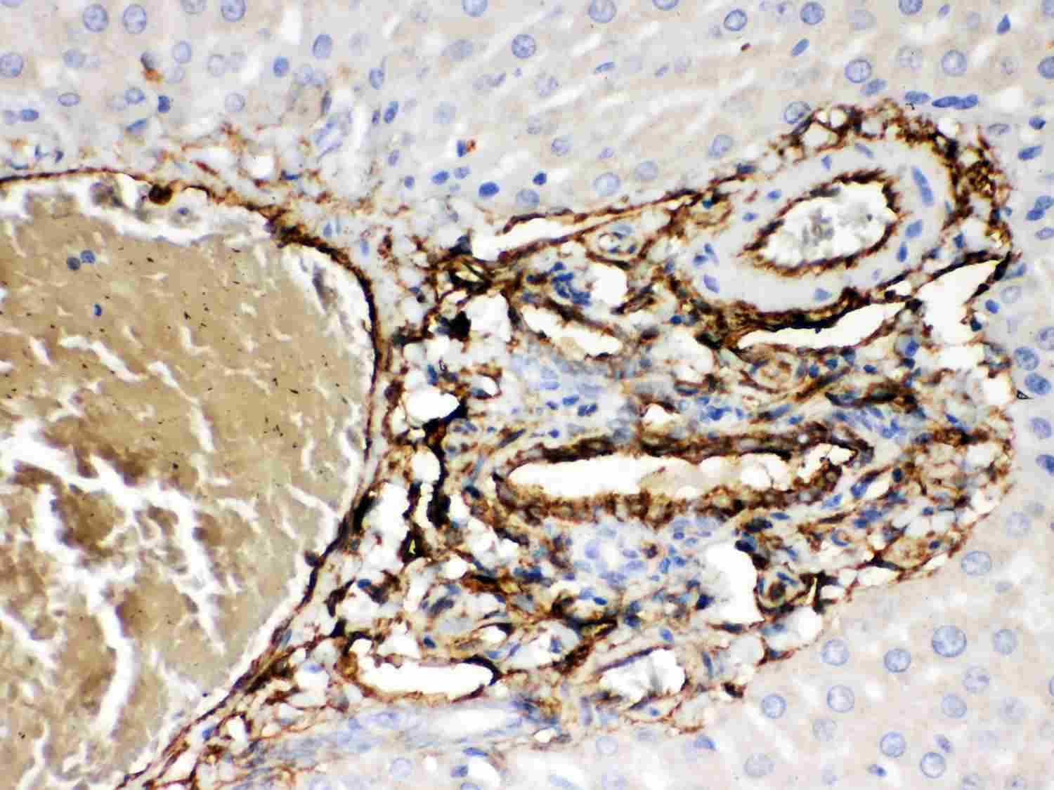 2 - Anti-ABCB4 Picoband Antibody ABO11966