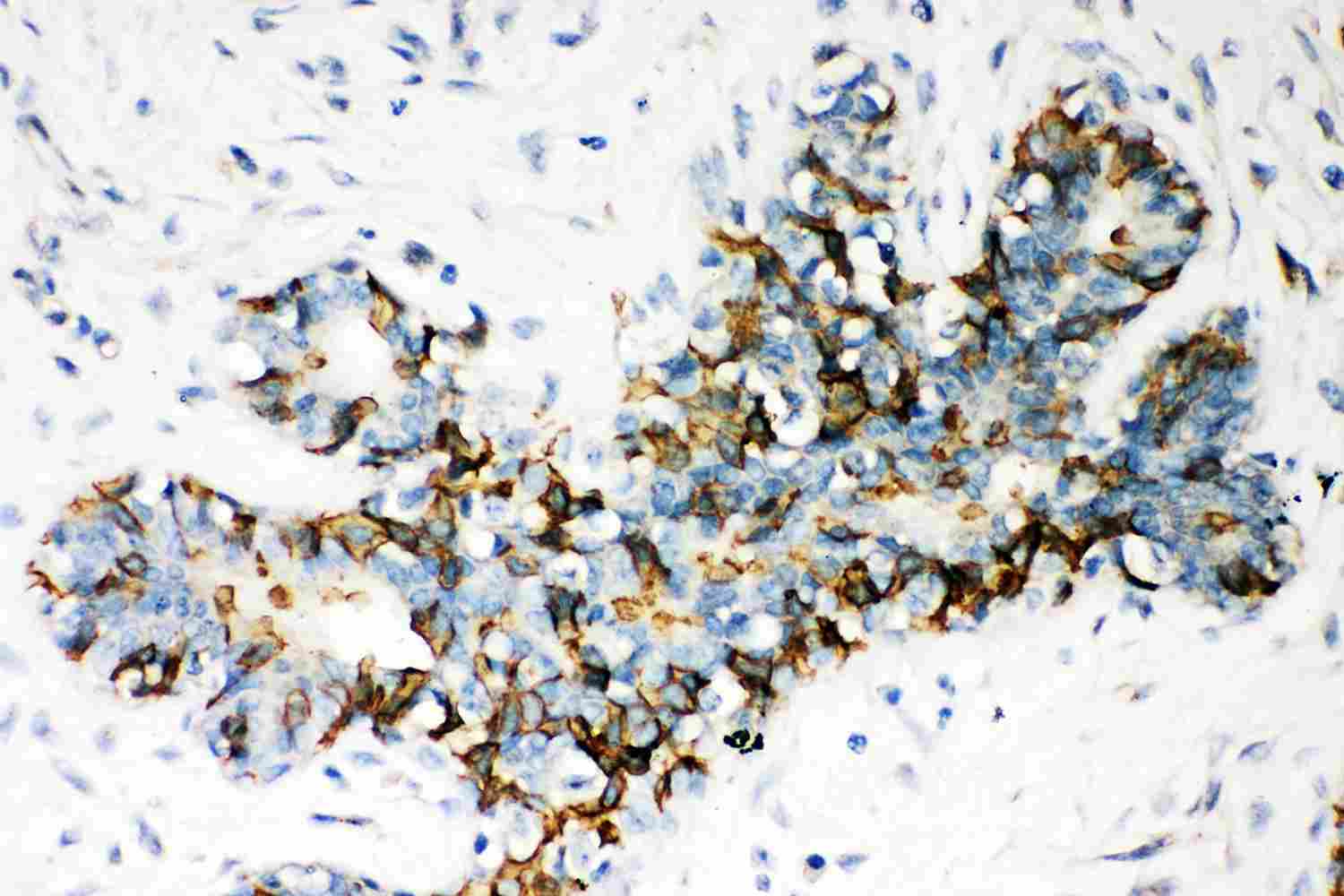 2 - Anti-ABCB4 Picoband Antibody ABO11966