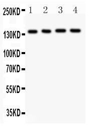 1 - Anti-ABCB4 Picoband Antibody ABO11966