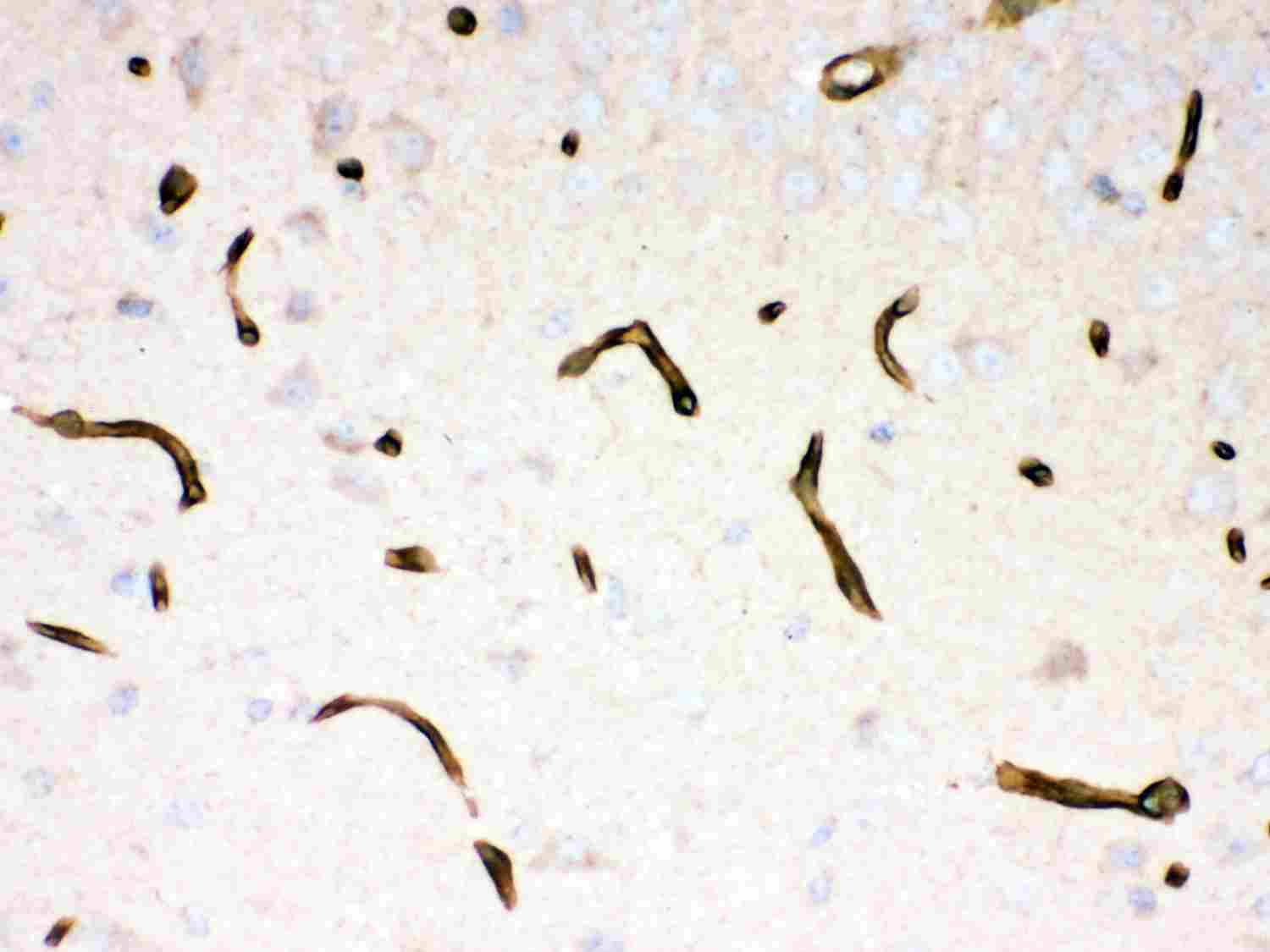 2 - Anti-Dystrophin Picoband Antibody ABO11967