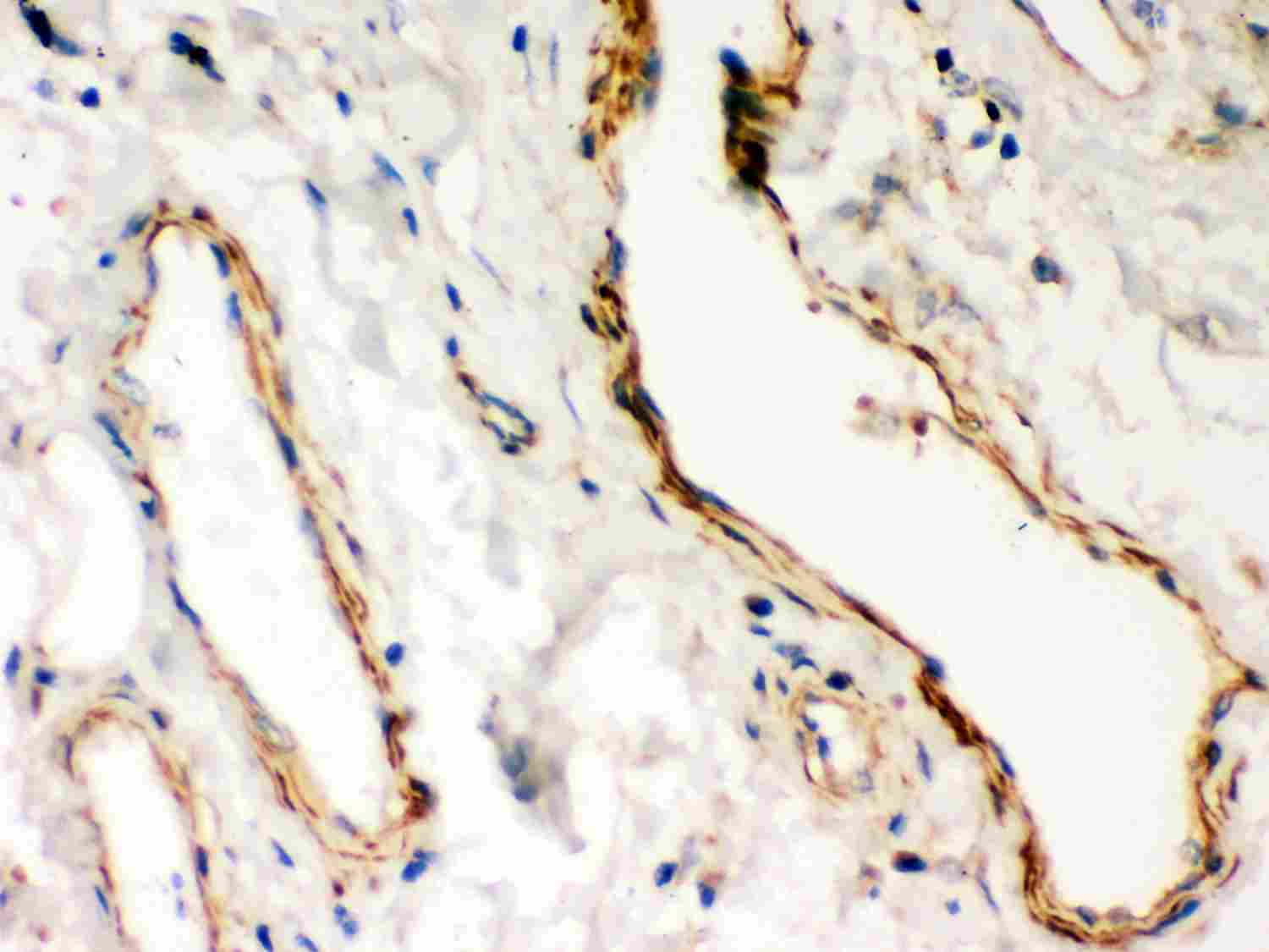 2 - Anti-Dystrophin Picoband Antibody ABO11967