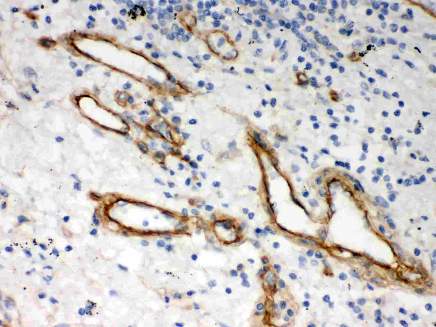 2 - Anti-HSPG2 Picoband Antibody ABO11968