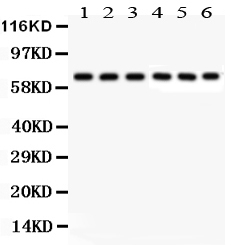 1 - Anti-Kininogen-1/KNG1 Antibody ABO11969