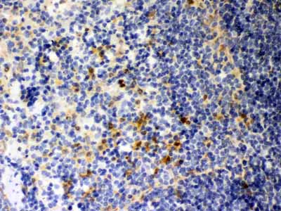 2 - Anti-Galectin-3/LGALS3 Antibody ABO11970