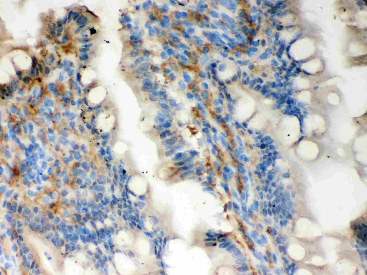 2 - Anti-Galectin-3/LGALS3 Antibody ABO11970