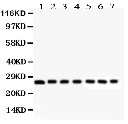 1 - Anti-Galectin-3/LGALS3 Antibody ABO11970