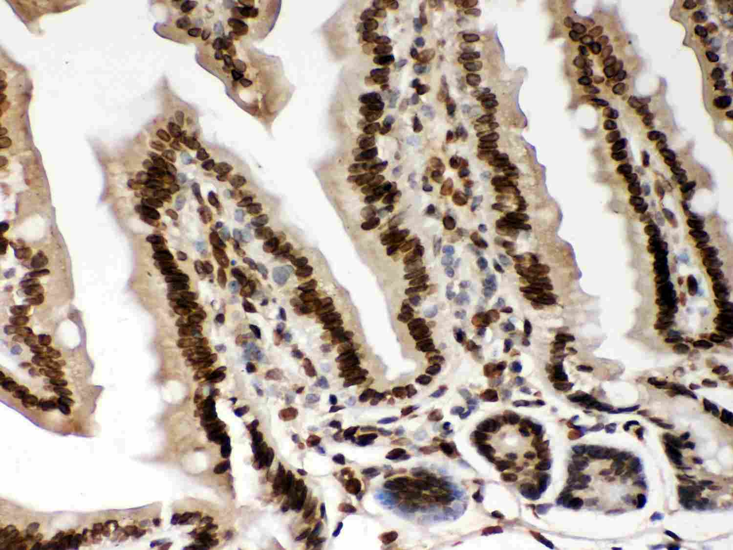 2 - Anti-Lamin A/C Picoband Antibody ABO11971