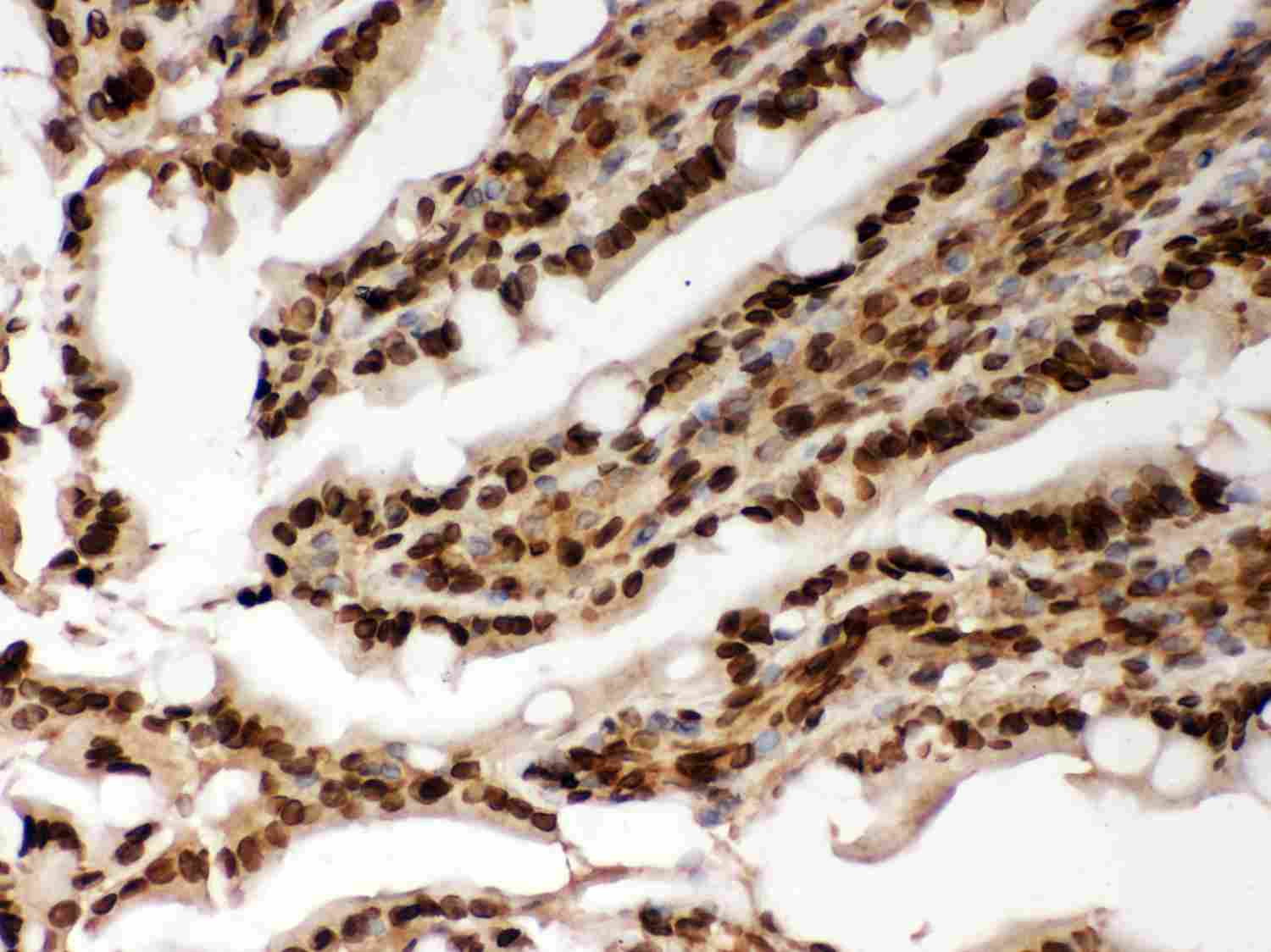 2 - Anti-Lamin A/C Picoband Antibody ABO11971