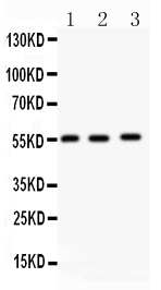 1 - Anti-MMP-14 Antibody ABO11974
