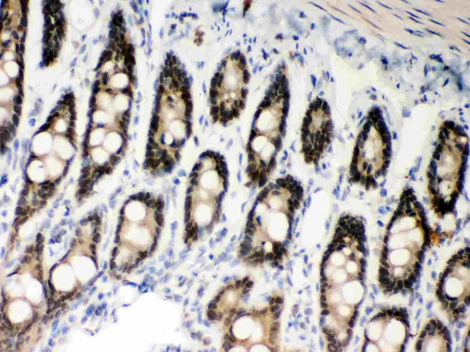 2 - Anti-MSH2 Picoband Antibody ABO11975