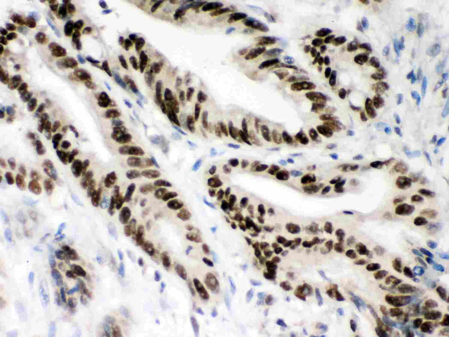 2 - Anti-MSH2 Picoband Antibody ABO11975