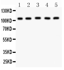 1 - Anti-MSH2 Picoband Antibody ABO11975