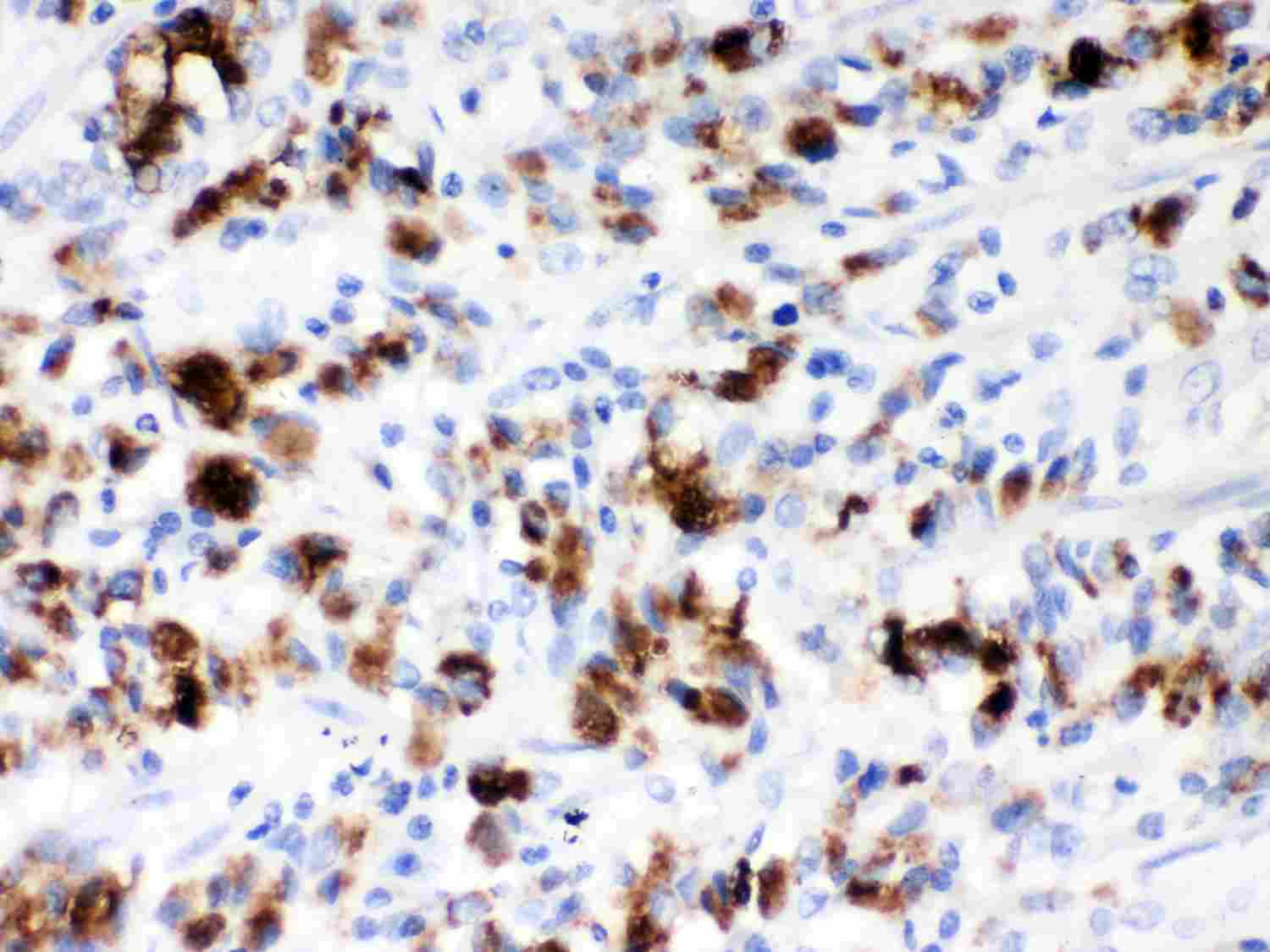 2 - Anti-Mucin 5AC Picoband Antibody ABO11977