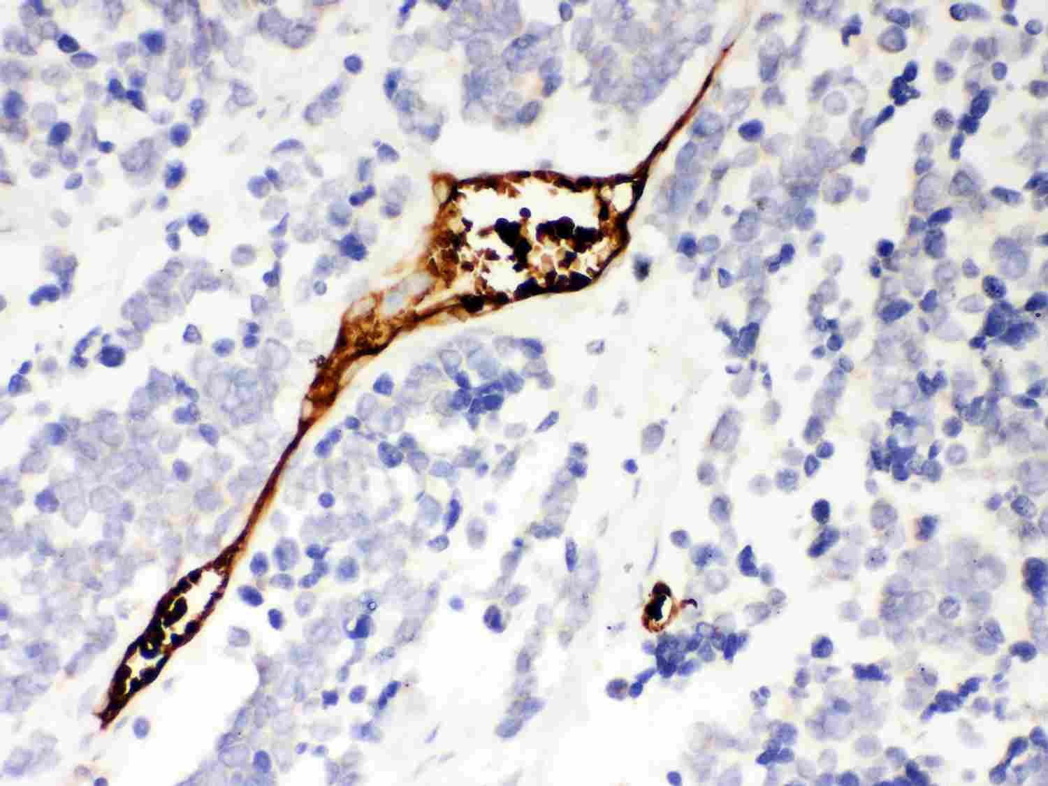 2 - Anti-Mesothelin Picoband Antibody ABO11978
