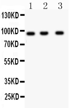 1 - Anti-HEF1 Picoband Antibody ABO11980