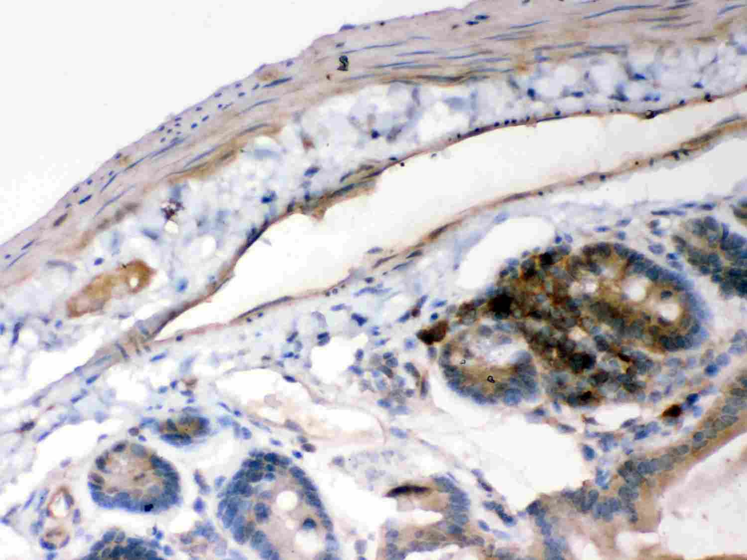 2 - Anti-IKB Alpha Picoband Antibody ABO11982