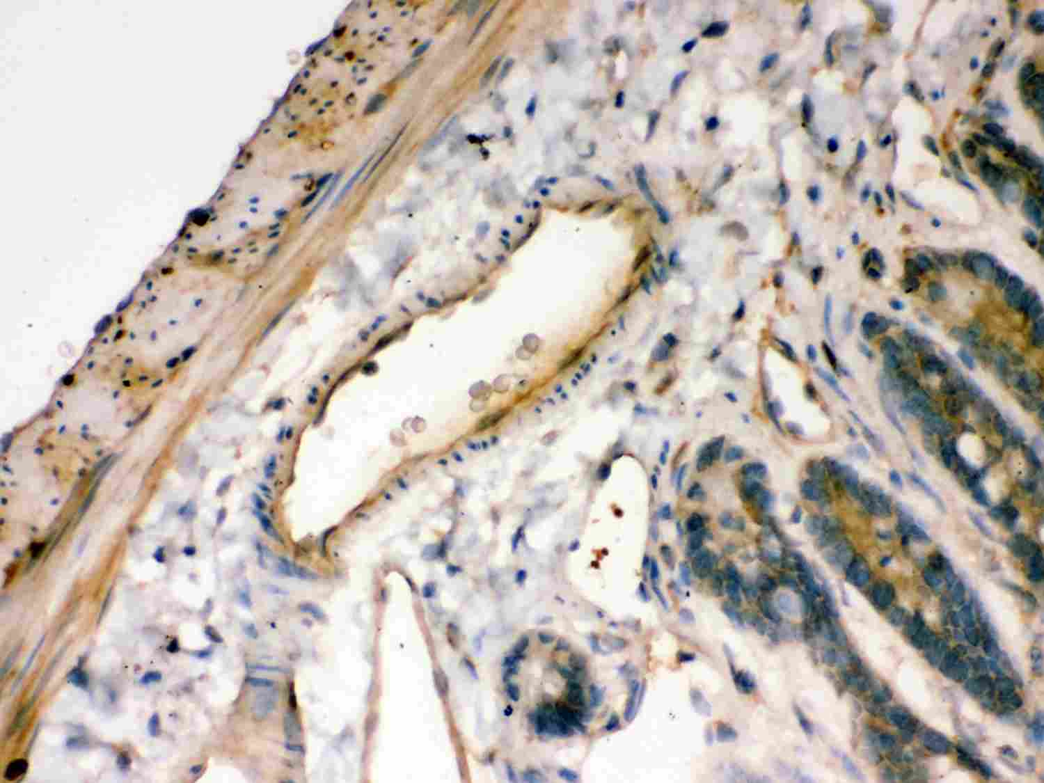 2 - Anti-IKB Alpha Picoband Antibody ABO11982