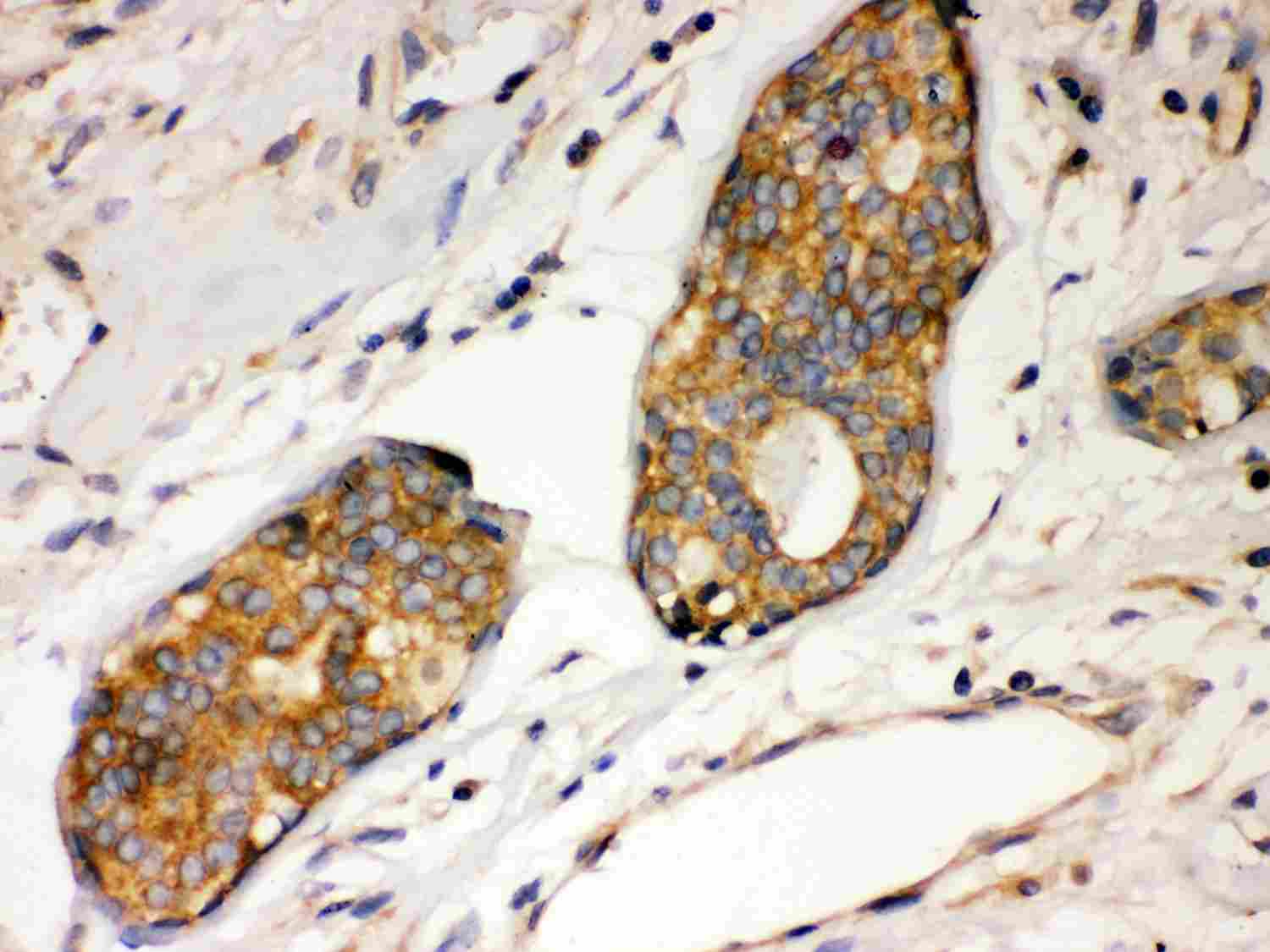 2 - Anti-IKB Alpha Picoband Antibody ABO11982