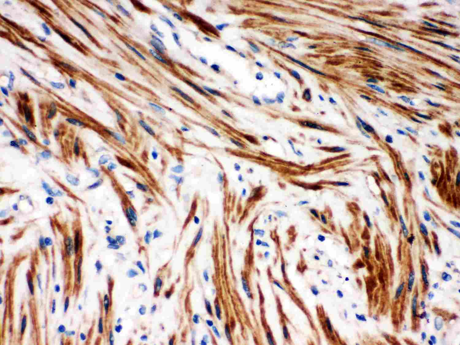 2 - Anti-IKB Beta Picoband Antibody ABO11983