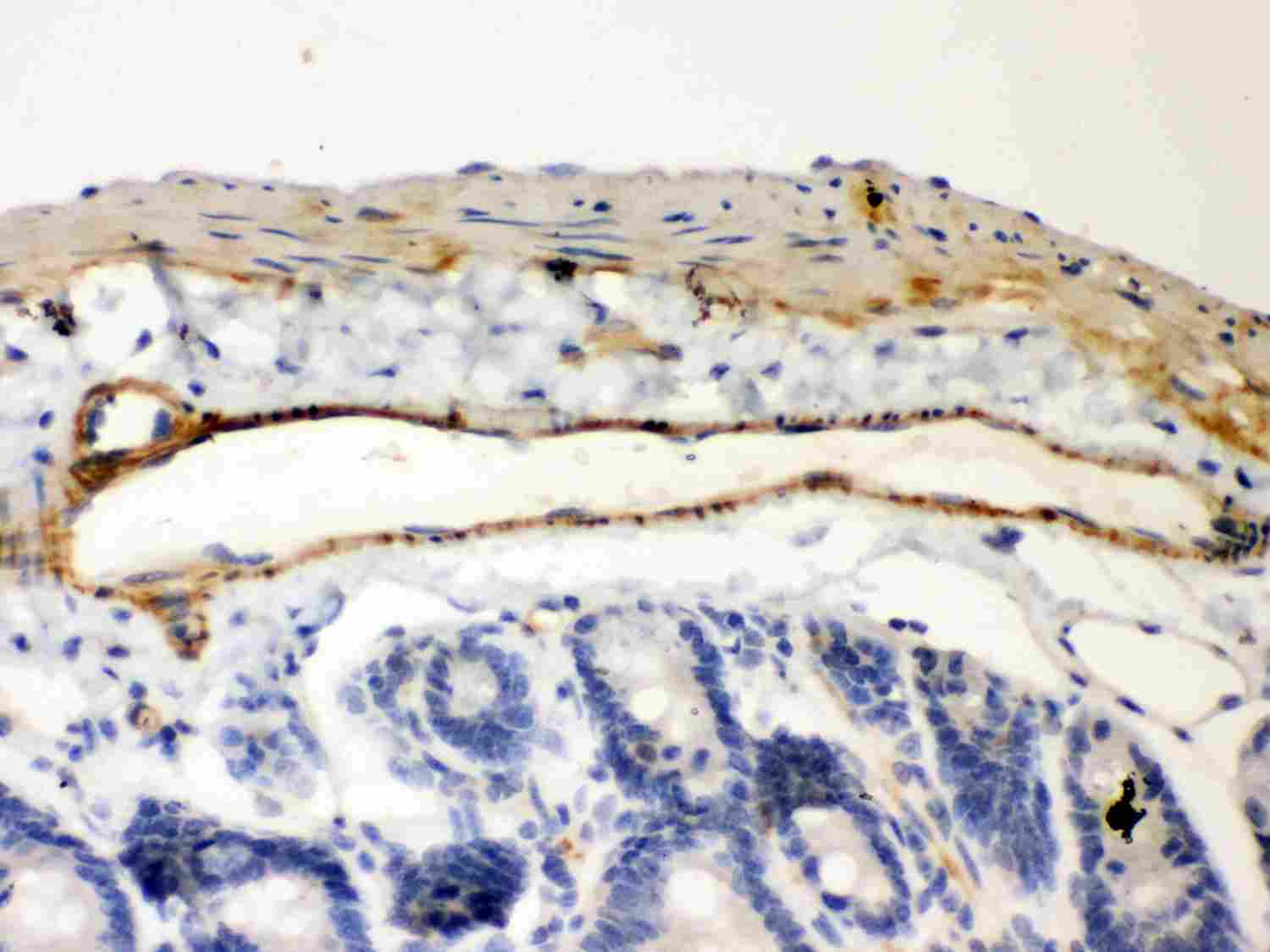 2 - Anti-IKB Beta Picoband Antibody ABO11983