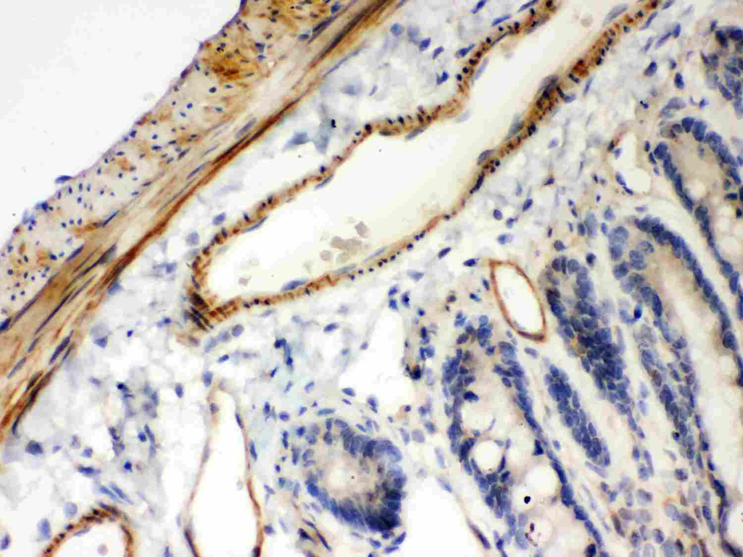 2 - Anti-IKB Beta Picoband Antibody ABO11983