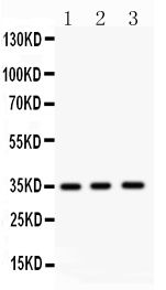 1 - Anti-Nkx2.5 Picoband Antibody ABO11984