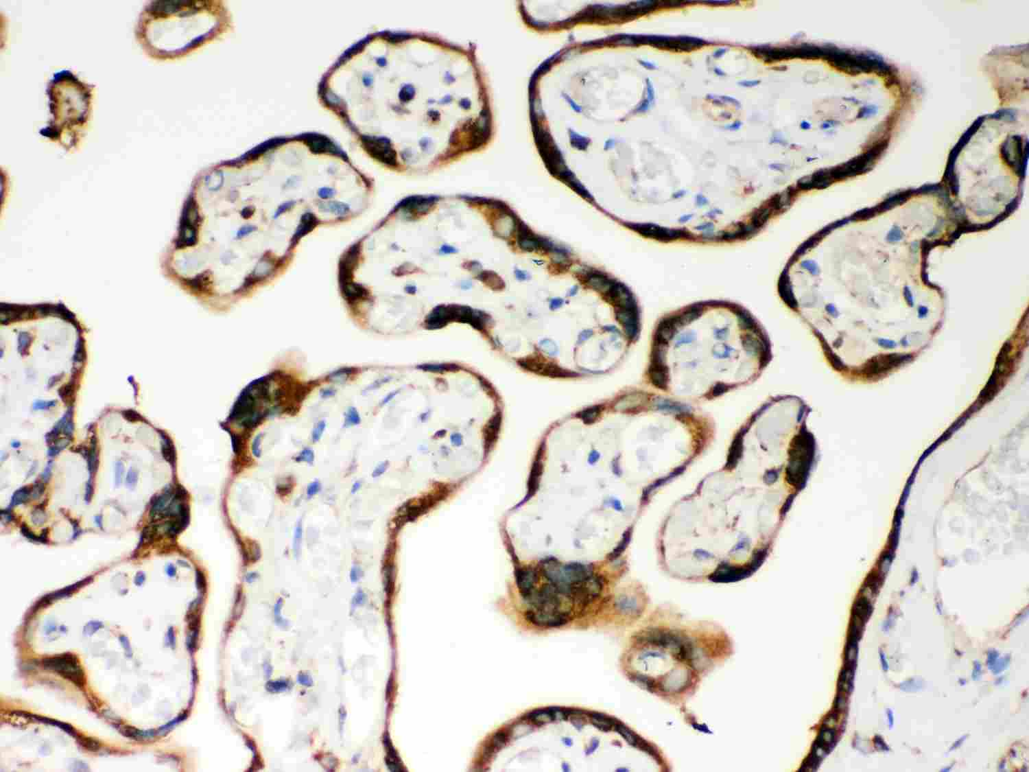 2 - Anti-CARD4 Picoband Antibody ABO11985