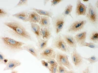 2 - Anti-CARD4 Picoband Antibody ABO11985