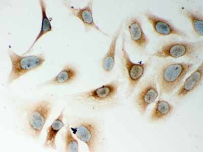 2 - Anti-CARD4 Picoband Antibody ABO11985